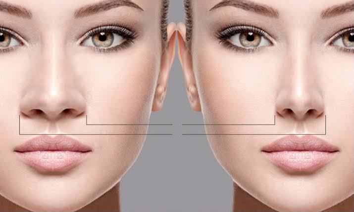 Ethnic rhinoplasty preserving individual features at EsteCenter Istanbul