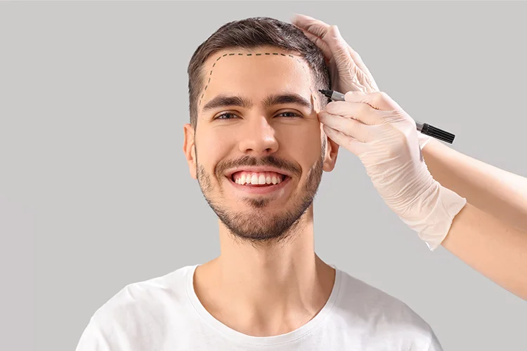 Hairline planning