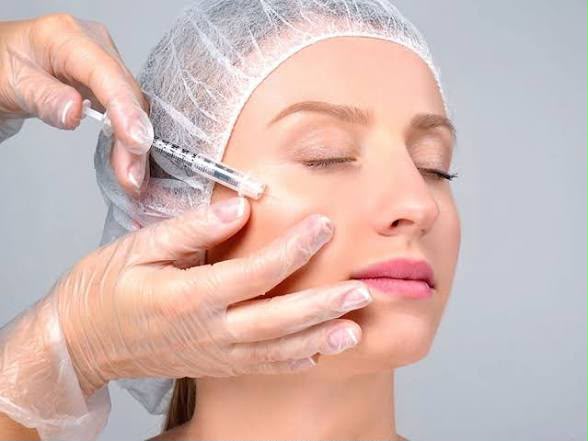 Cheek filler contouring at EsteCenter Istanbul