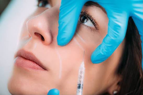 Collagen injection treatment at EsteCenter Istanbul