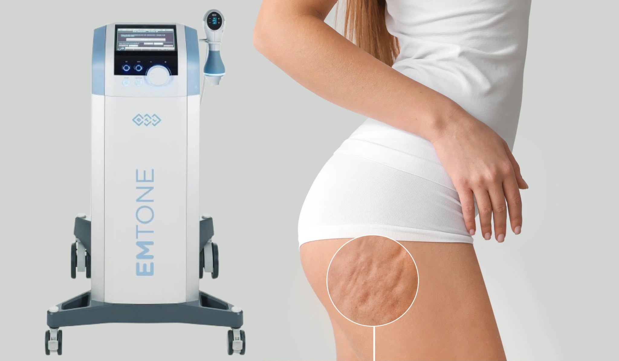 Emtone cellulite treatment at EsteCenter Istanbul