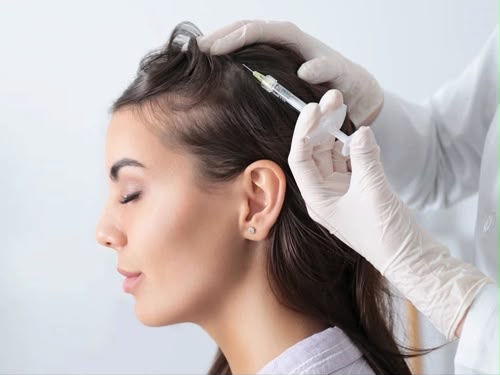 PRP platelet-rich plasma therapy at EsteCenter Istanbul